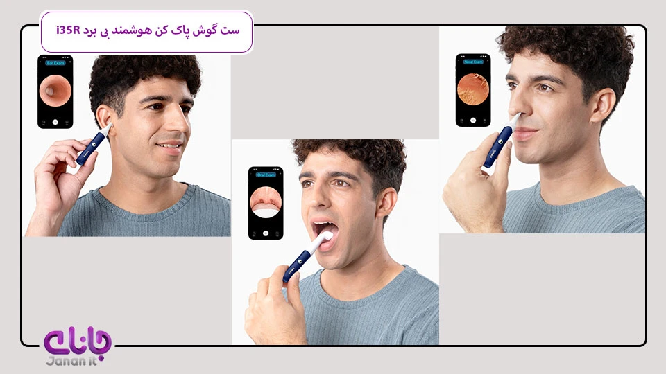 گوش پاک کن و جرم گیر هوشمند Bebird EarSight Plus